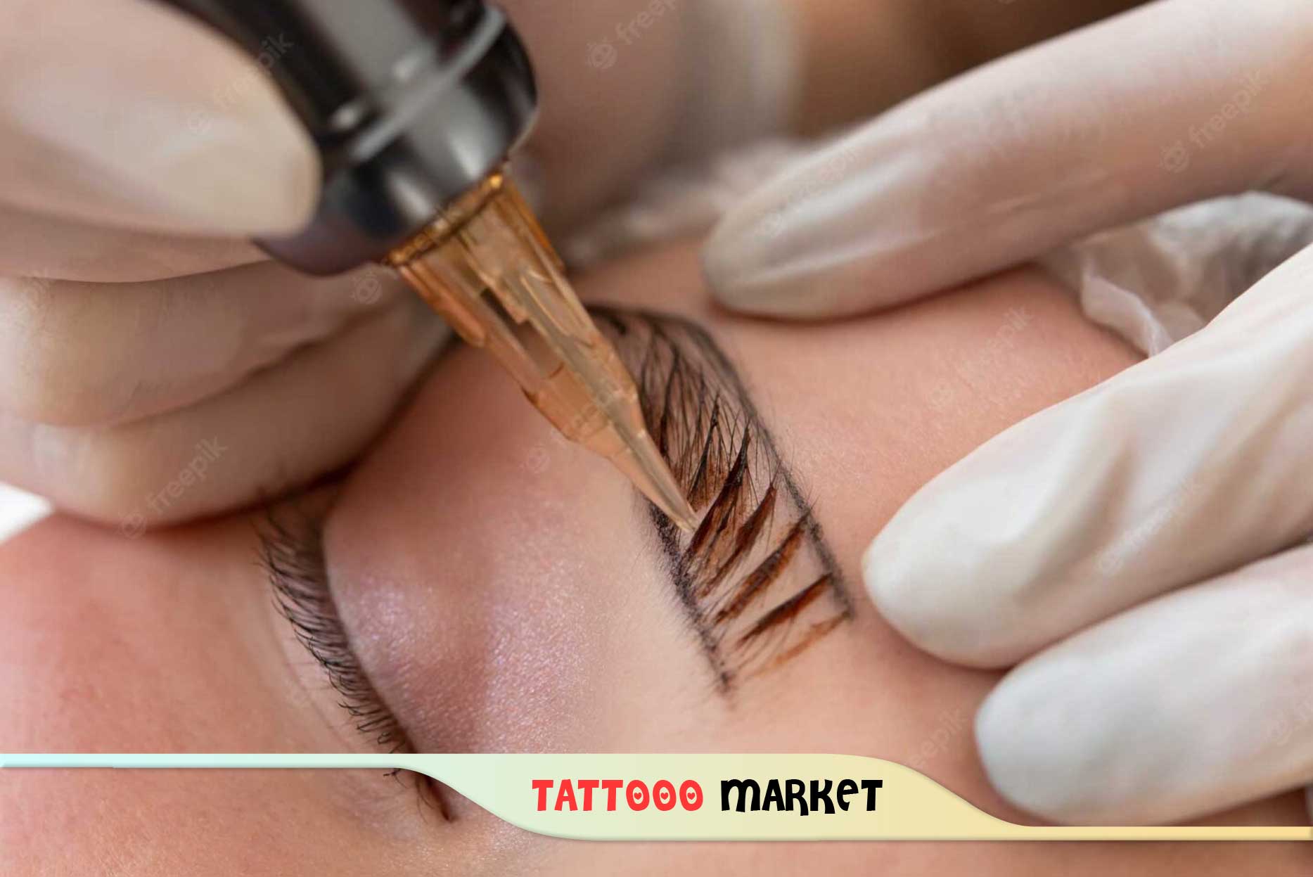 میکروبلیدینگ